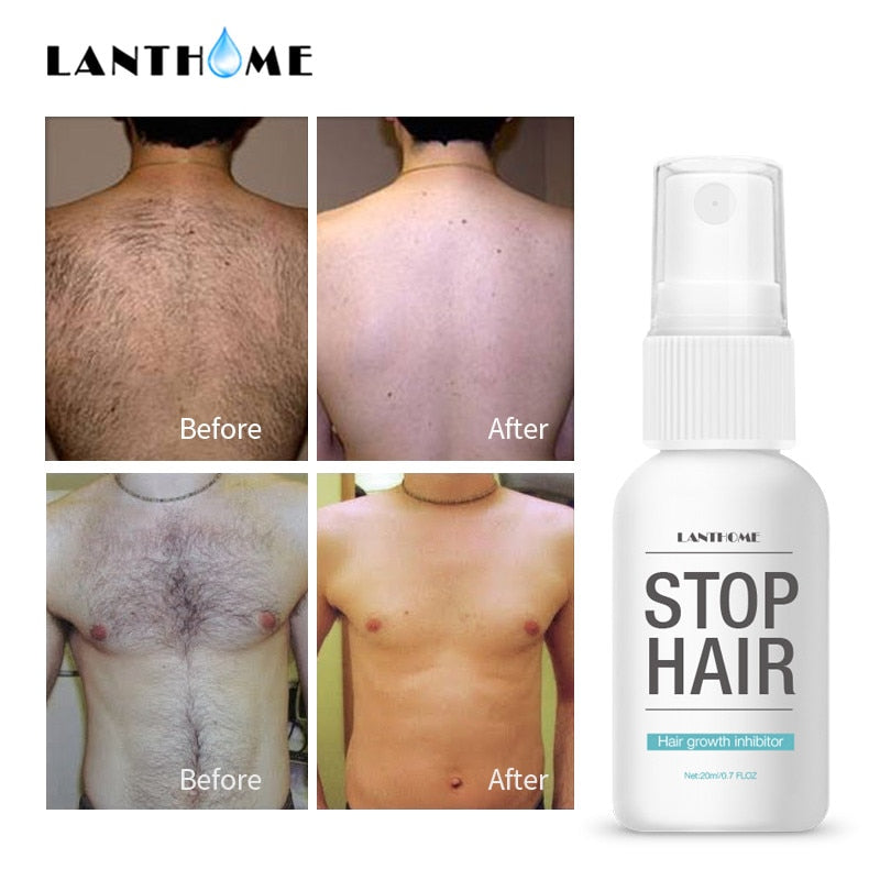 Stop Hair Serum